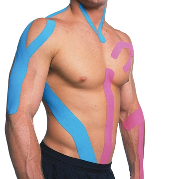 kinesio taping