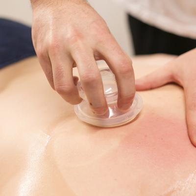 Cupping